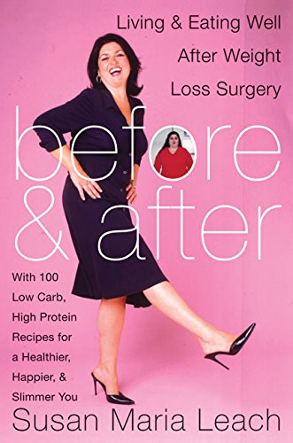 cover image BEFORE AND AFTER: Living and Eating Well After Weight Loss Surgery